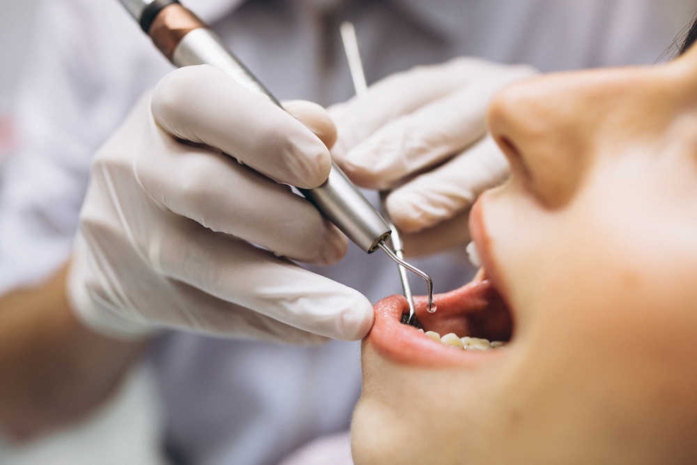 Prevenção de Doenças Bucais